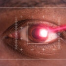 opération astigmatisme rouen