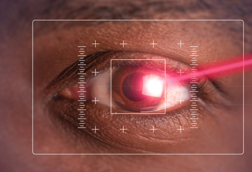 opération astigmatisme rouen