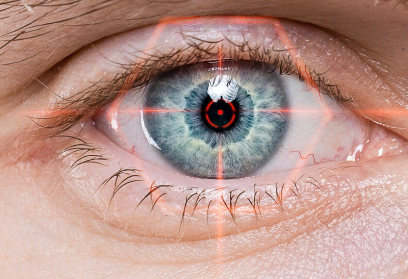 opération myopie rouen