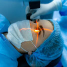 opération presbytie rouen